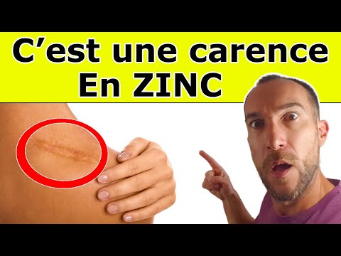 Vidéo: Combien de temps la carnosine de zinc agit-elle ?