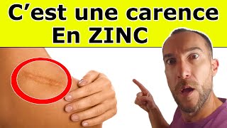 5 SIGNES qui montrent que vous manquez de ZINC