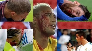 I am sport brings you to real sports - top 5 blood injuries | lionel
messi cristiano ronaldo neymar jr kylian mbappe sergio ramos. thank
