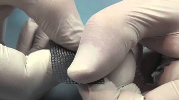 How to use titanium meshes by Maxil