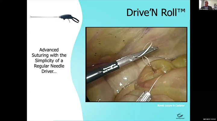 ErgoSuture - Virtual Rocket Pitch presentation at ...