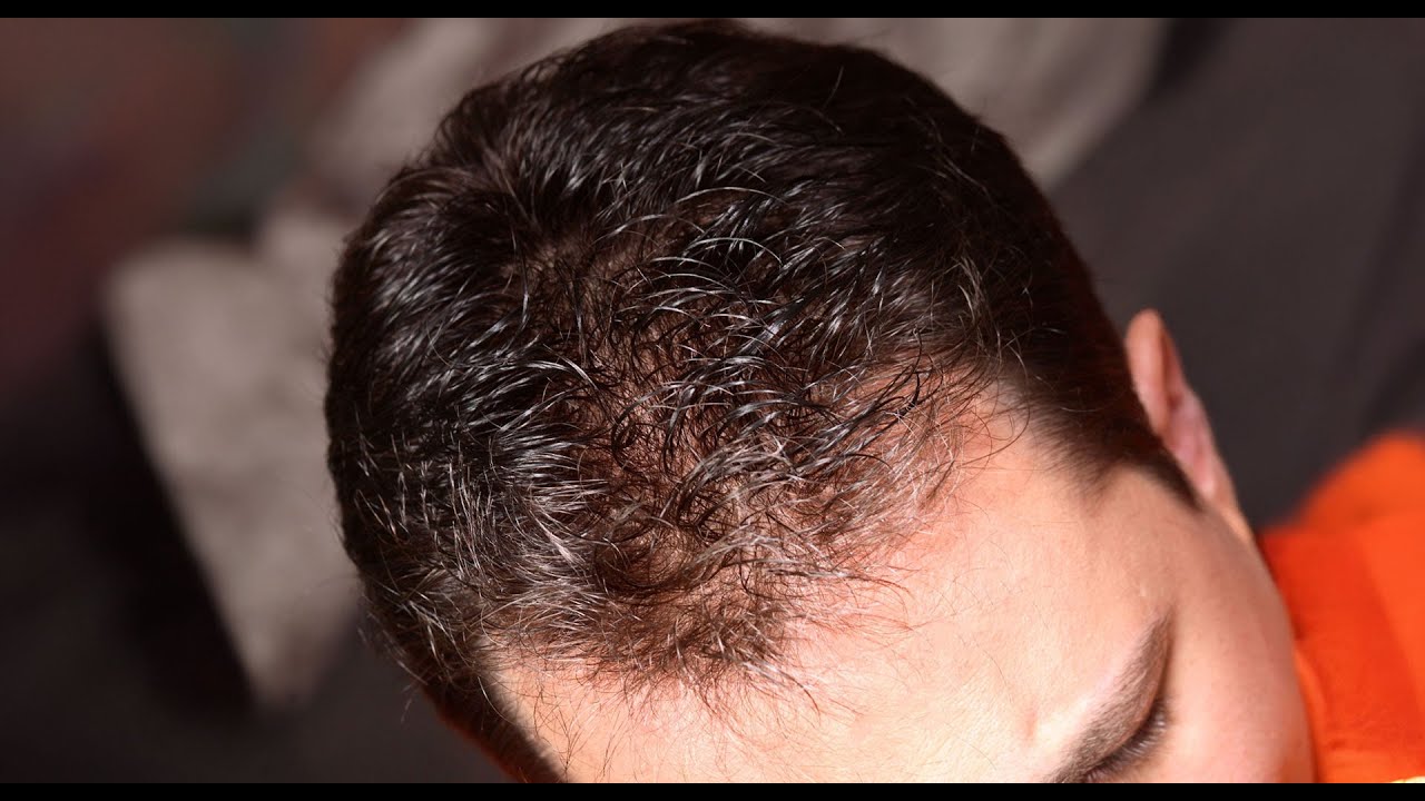 Incredible Hair Transformation - InVisions of Connecticut