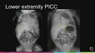 Radiology Case Review: Pediatric Imaging - Sample