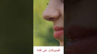 غلاج حصى الكلى بالاعشاب الطبيعيه