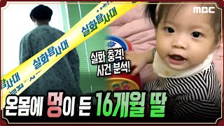 [실화충격] 온몸에 멍이 든 16개월 딸 #실화탐사대 #실화On MBC190417방송