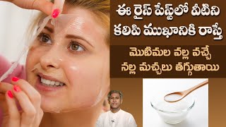 Face Pack to Remove Pimples | Removes Dead Cells | Improves Skin Tone |Dr.Manthena's Beauty Tips