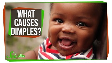 What Causes Dimples?