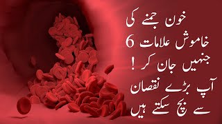 خون جمنے کی 6 خاموش علامات ! جنہیں جان کر آپ بڑے نقصان سے بچ سکتے ہیں | Silent Blood Clot Symptoms