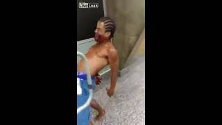 Man Presents as Zombie in Brazil Hospital screenshot 1