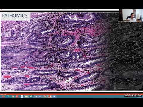 Machine Learning for Pathology - Lecture 19 - MIT Deep Learning in the Life Sciences (Spring 2021)