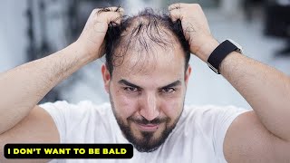 I Don't Want To Be Bald l Thin Hair Transformation by Barber