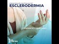 Principales síntomas de Esclerodermia