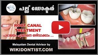 Root Canal Treatment - പരാജയം എങ്ങനെ ഒഴിവാക്കാം  // ദന്ത രോഗ പരിപാലനം  //മലയാളം // Dental videos