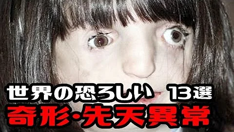 تحميل 閲覧注意 恐怖の難病 奇形人間 奇形児画像 ココロ刺激