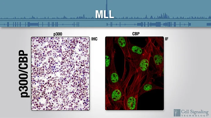 Epigenetic Drivers of Leukemias