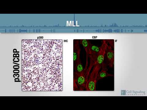 Video: Un T Neobișnuit (9; 11) (p24; Q22) Cu Pierdere Monoalelică A Genelor ATM și KMT2A La Un Copil Cu Sindrom Mielodisplastic / Leucemie Mieloidă Acută Care A Evoluat Din Anemia Fanconi