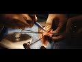 Circoncision au bloc opératoire - Dr Marc GALIANO