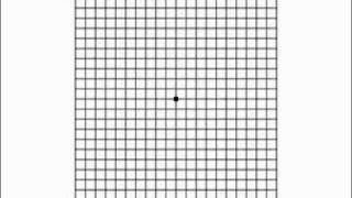 AMD Test Amsler Grid