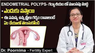 గర్భాశయ పాలిప్స్ | How To Deal With Endometrial Polyp For Pregnancy | Fertility Tips Telugu | Ferty9