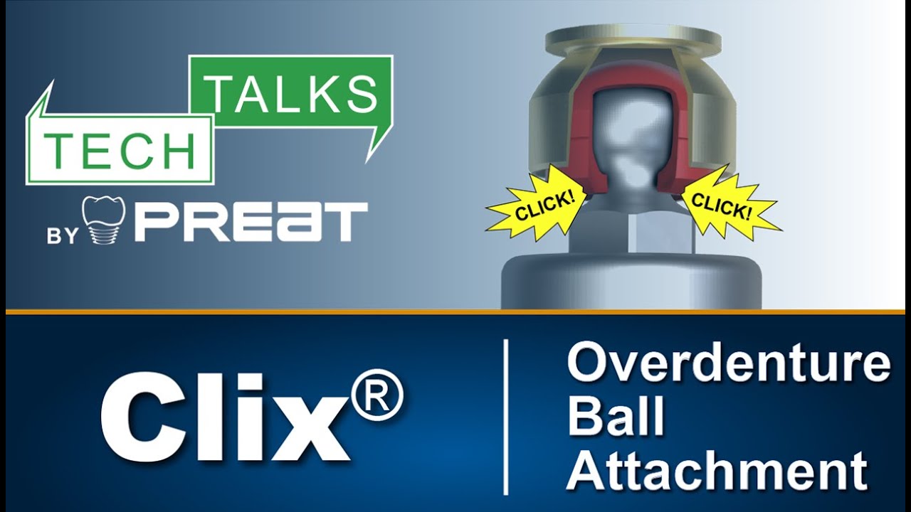 Clix Ball Abutment Overview - Tech Talks By PREAT