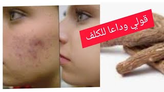 وصفة عرق السوس لإزالة الكلف والبقع الداكنة واثار حب شباب والنتيجة مضمونة من اول استعمال