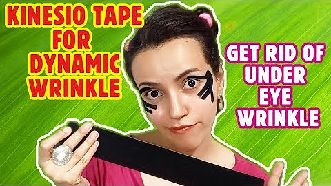 Dynamic or Static Wrinkles? Get rid of Under Eye Wrinkle with Taping| Fade Puffy eye| No Botox