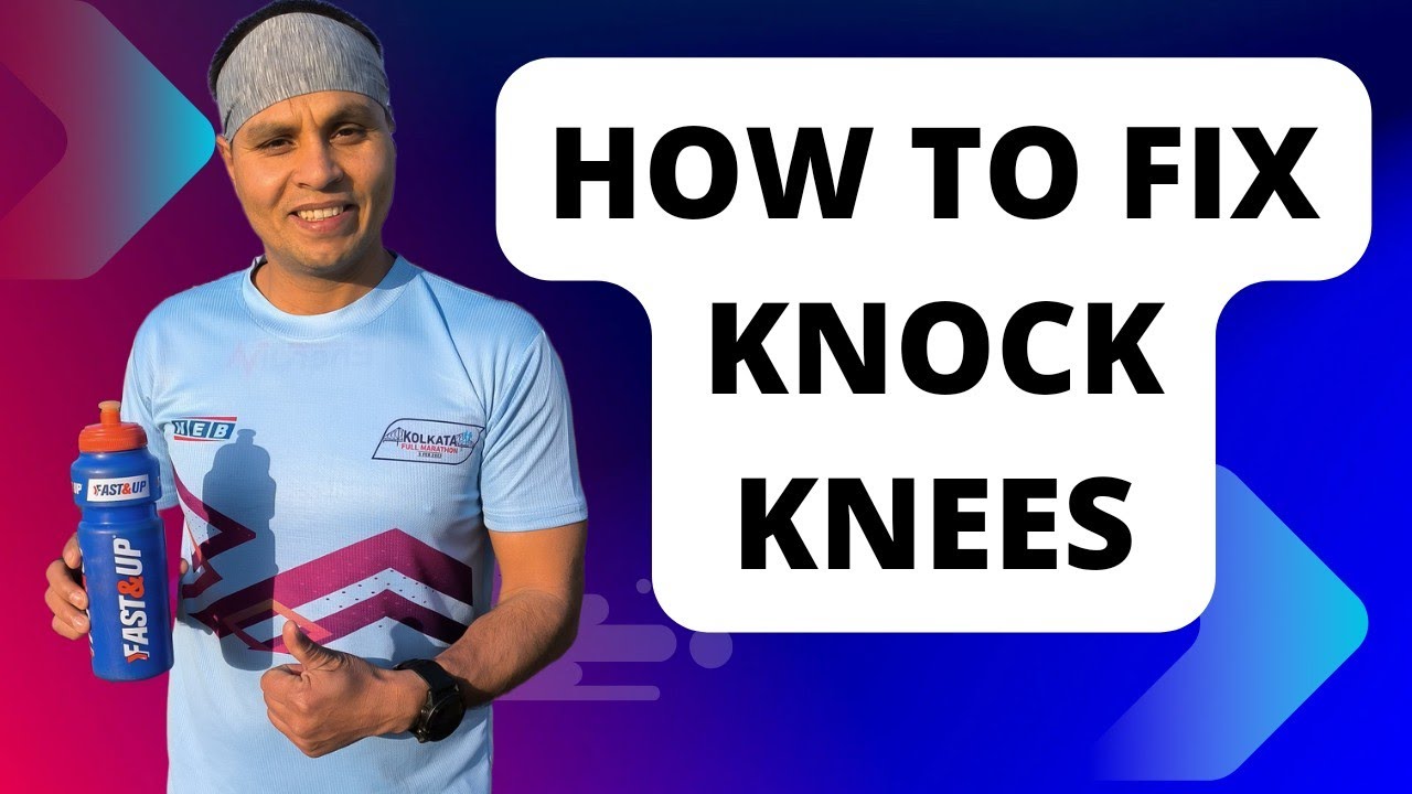 How to Fix Knock knees Best Exercise for Knock Knees Knock Knees Army Bharti Police