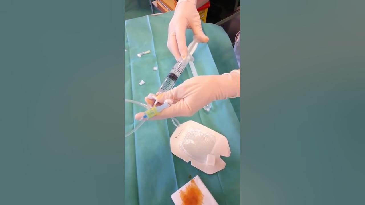 Perfusion dans chambre implantable mise en pratique (UE 4.4 S5) YouTube