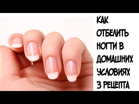 Как отбелить ногти в домашних условиях ///3 самые эффективные маски