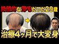 【若ハゲ】絶望的だった20代の薄毛男性がAGA治療をはじめて4ヶ月で大変身!