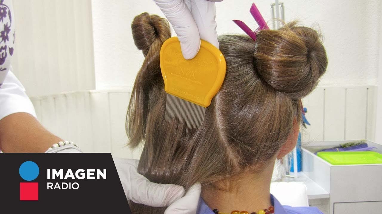 ¿Cuál es la forma más efectiva de eliminar los piojos? / Bien y ...