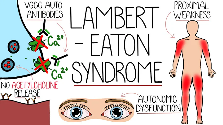 Understanding Lambert-Eaton Myasthenic Syndrome (LEMS Explained)