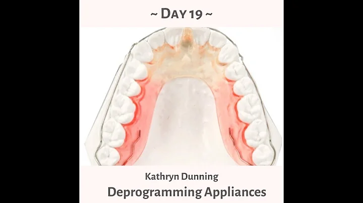 90 Day Dental Day 19- Kathryn Dunning - Deprogramm...