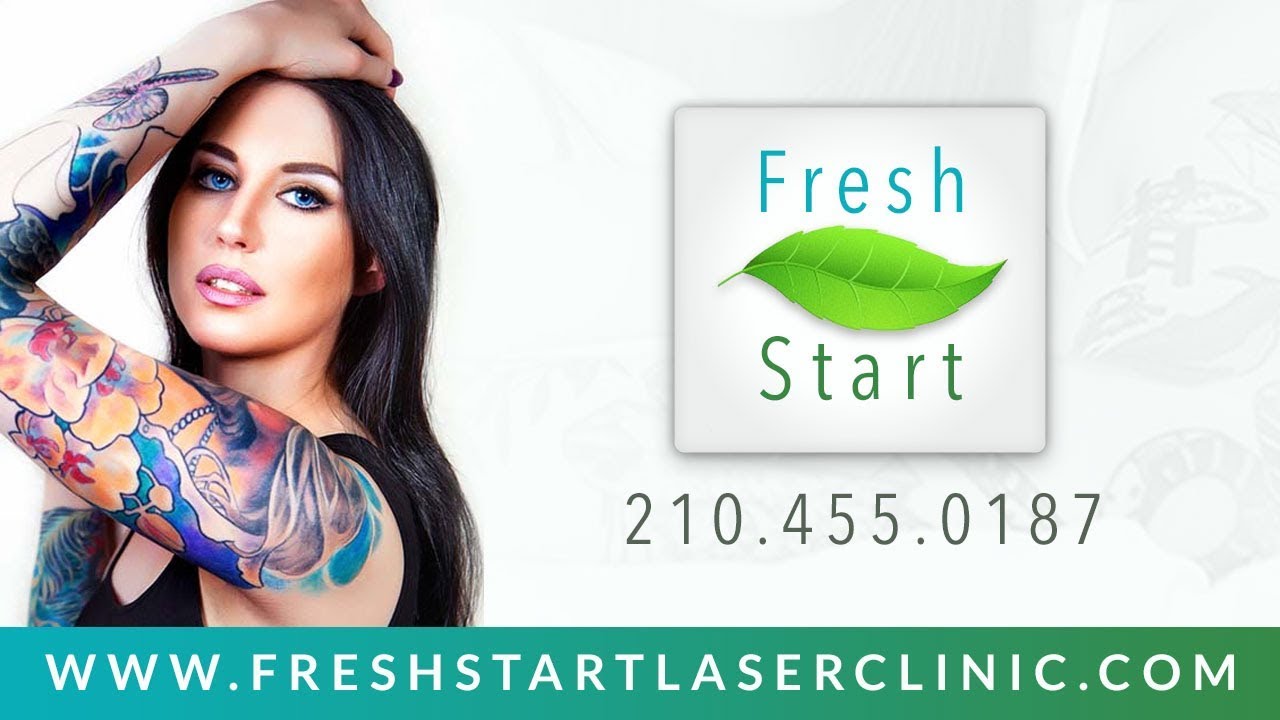 Fresh Start Laser Tattoo Removal Clinic San Antonio