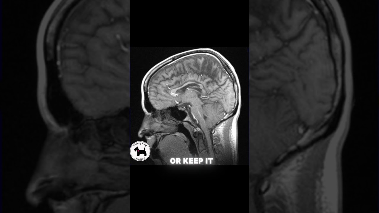 MRI Song - Lay Still And Don't Ask Why