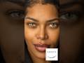 The beautiful Jessica White came to our #keratonyc practice to have her #eyecolorchange procedure✨