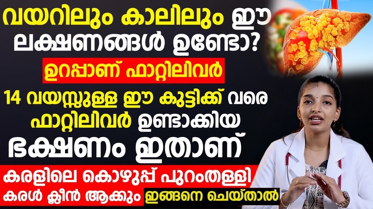കുട്ടികൾക്ക് വരെ ഫാറ്റിലിവറിനു കാരണം ഈഭക്ഷണമാണ്,ഈ ലക്ഷണം ഉണ്ടോ എന്ന് ഇപ്പോൾ തന്നെ നോക്കു fatty liver