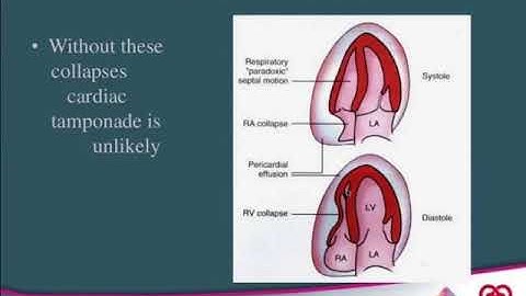 Siêu âm tim cấp cứu tại giường - Bộ môn Tim mạch, Y Hà Nội