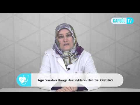 Ağız Yaraları Hangi Hastalıkların Belirtisi Olabilir?