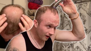 SHAVING OFF My BALDING INSECURITY *Epic Moment*