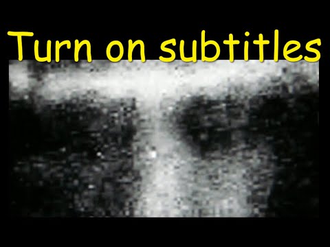 Video: The Age Of The Shroud Of Turin Will Be Re-calculated - Alternative View