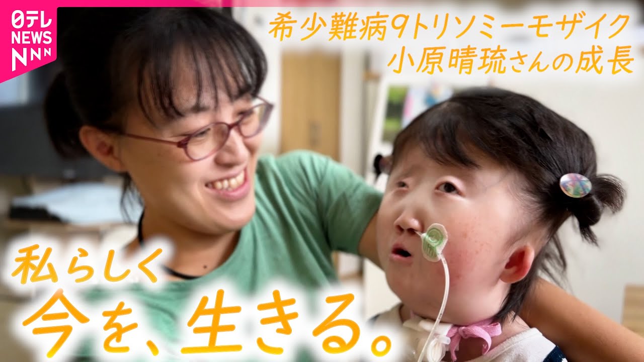 密着】世界で50人の希少難病 