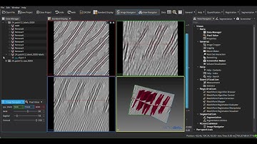 MemBrain-seg S01E04: Patch correction: Remove label