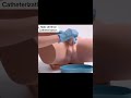 male urethal catheterization #nurselife #usnurse #anatomy #doctor #nursingoffice #nursing #minivlog