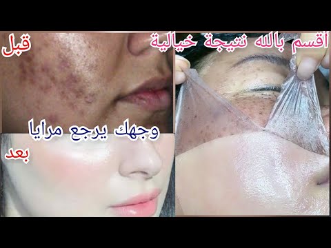 Vidéo: 3 façons simples d'éliminer le bronzage de votre visage