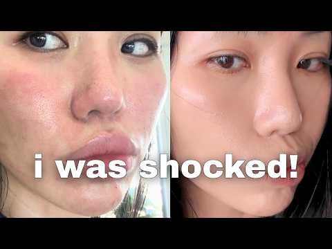 how i HEALED my skin barrier in 4 days (it worked insanely well) thumbnail