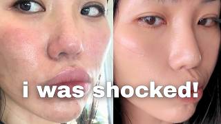 how i HEALED my skin barrier in 4 days (it worked insanely well)