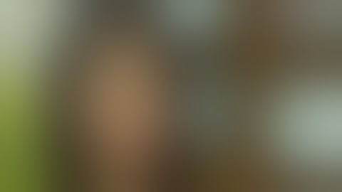 Nâng ngực đẹp | Nâng ngực nội soi túi Nano Chip đẹp 2018