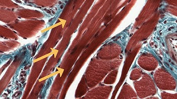 Skeletal Muscle Longitudinal Section