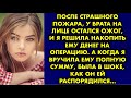 После страшного пожара у брата на лице остался ожог и я решила накопить ему денег на операцию…